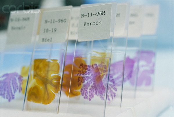 Pathology consumable