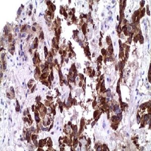 Alpha-Fetoprotein (EP209)