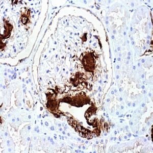 Amyloid A (MC1)