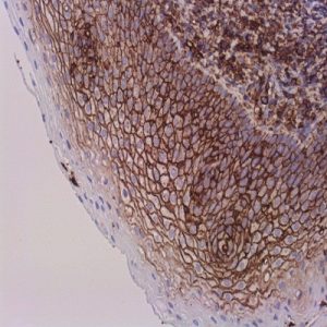 CD44 (SP37)