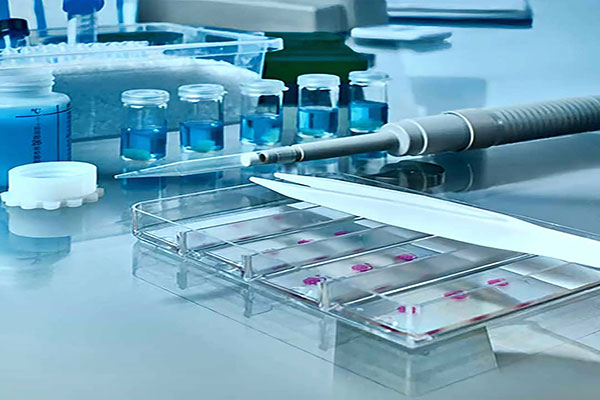 آنتی-بادی-IHC